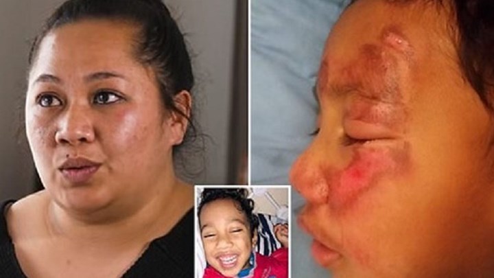 Φρίκη: Δασκάλα κακοποίησε παιδί με εγκεφαλική παράλυση – ΦΩΤΟ – BINTEO