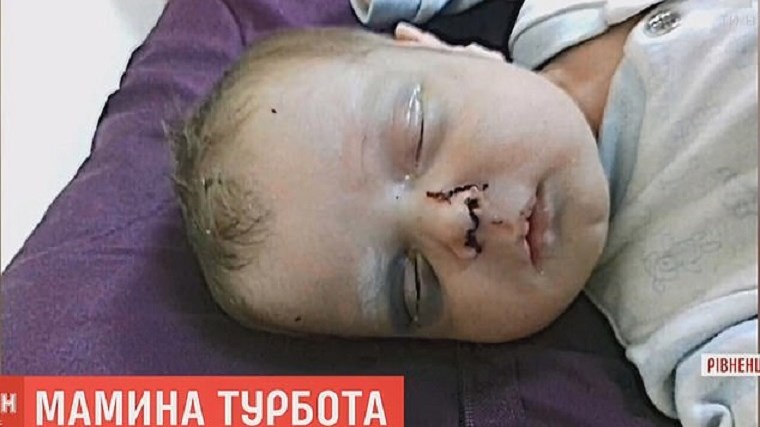Φρίκη στην Ουκρανία: Μητέρα έσπασε στο ξύλο το ενός μηνός μωρό της – Δίνει μάχη για τη ζωή του – ΦΩΤΟ
