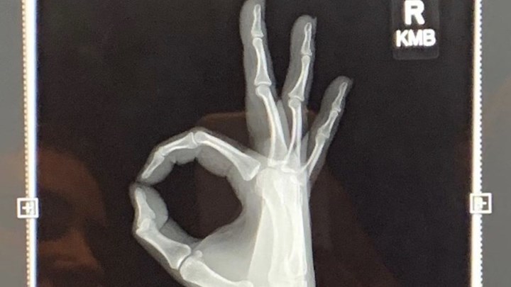 Διάσημη τραγουδίστρια έπεσε από την σκηνή ενώ χόρευε με θαυμαστή της – Έκανε ακτινογραφίες σε όλο της το σώμα – ΦΩΤΟ – ΒΙΝΤΕΟ