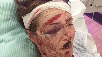 Συμμορία άφησε ετοιμοθάνατο ζευγάρι έπειτα από ενέδρα – ΦΩΤΟ