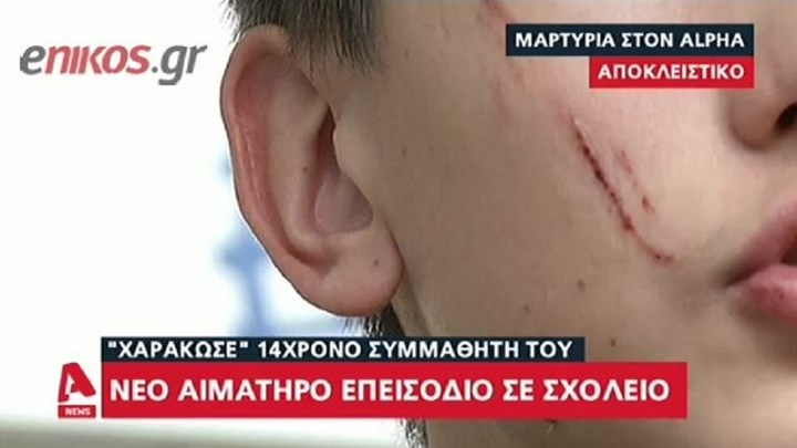 Νέο αιματηρό περιστατικό σε σχολείο: 14χρονος χαράκωσε συμμαθητή του με κλειδιά – ΒΙΝΤΕΟ