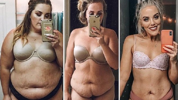 Η δύναμη της θέλησης – Έχασε 68 κιλά και έγινε αγνώριστη – ΦΩΤΟ – ΒΙΝΤΕΟ