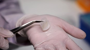 Έφτιαξαν ανθρώπινο δέρμα σε εργαστήριο – ΒΙΝΤΕΟ