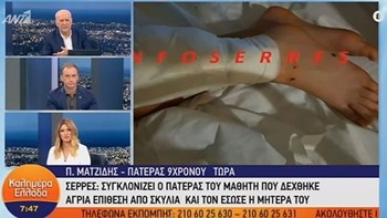 Πατέρας του 9χρονου που δέχθηκε άγρια επίθεση από σκυλιά: Ένα χρόνο του έκανα παράπονα να μαζέψει τα σκυλιά