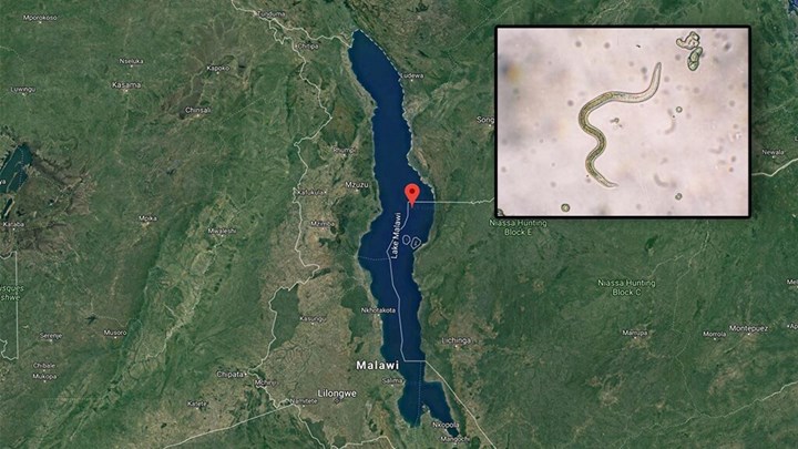 Η βουτιά σε λίμνη έγινε εφιάλτης για 32χρονο – Παρασιτικό σκουλήκι εισχώρησε στο μόριο του και γέννησε τα αυγά του