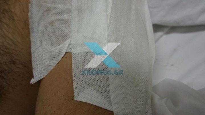 Φωτογραφίες – ντοκουμέντο από την επίθεση με μαχαίρι σε αστυνομικό