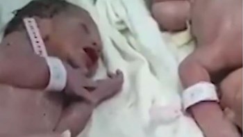 Το θαύμα της ζωής στην Αλβανία – Γεννήθηκαν δίδυμα λίγα λεπτά μετά τον φονικό σεισμό – ΒΙΝΤΕΟ