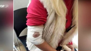 Επίθεση από αδέσποτο σκύλο δέχθηκε γυναίκα στη Λαμία – ΒΙΝΤΕΟ
