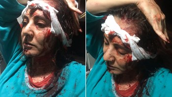 Πρώην CEO της Amazon ξυλοκόπησε με ρόπαλο τη σύζυγό του – Το διαζύγιο, ο εκτελεστής και οι καταγγελίες της κόρης τους – ΦΩΤΟ – ΒΙΝΤΕΟ