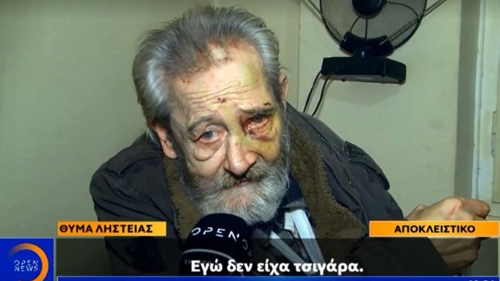 Αδίστακτοι ληστές βασάνισαν χωρίς έλεος ηλικιωμένο στα Πατήσια – ΒΙΝΤΕΟ