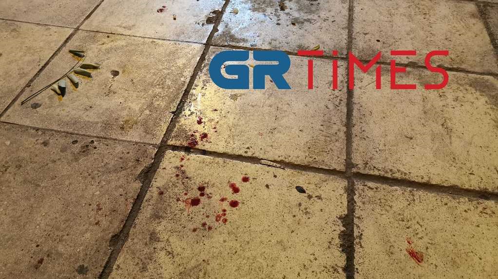 Θεσσαλονίκη: Αιματηρή συμπλοκή μεταξύ αλλοδαπών – Προσοχή ΣΚΛΗΡΕΣ ΕΙΚΟΝΕΣ – ΒΙΝΤΕΟ