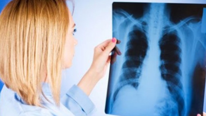 Google Health: Έξυπνη εφαρμογή θα “διαβάζει” πλέον και ακτινογραφίες πνευμόνων