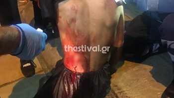 Θεσσαλονίκη: Σοκαριστικές εικόνες από θύμα ληστείας – ΦΩΤΟ