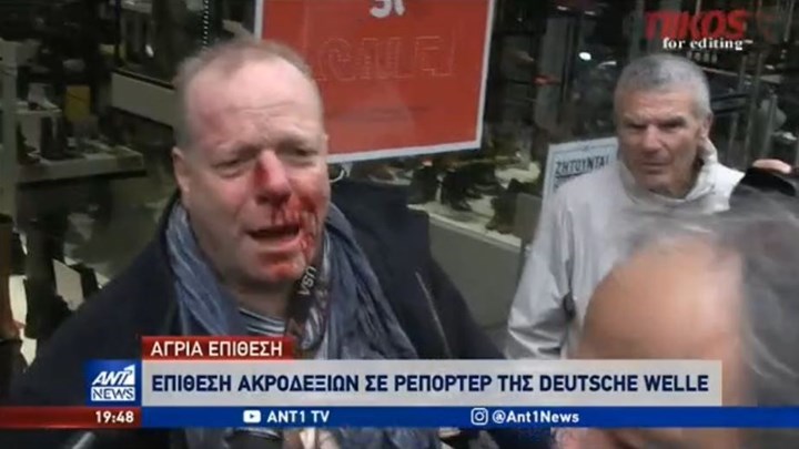 Επίθεση σε φωτορεπόρτερ της DW –  Η απάντησή του: Είσαι μια δειλή κατσαρίδα – ΒΙΝΤΕΟ