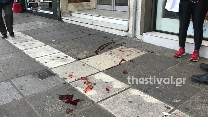 Σοκ στη Θεσσαλονίκη: Τον μαχαίρωσε για να του κλέψει το κινητό  – ΦΩΤΟ