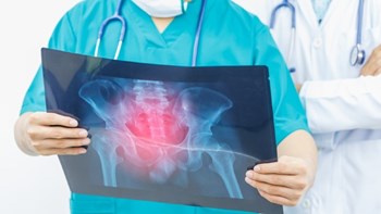 Εκτίμηση-σοκ από τον ΠΟΥ για τα κρούσματα καρκίνου τα επόμενα 20 χρόνια