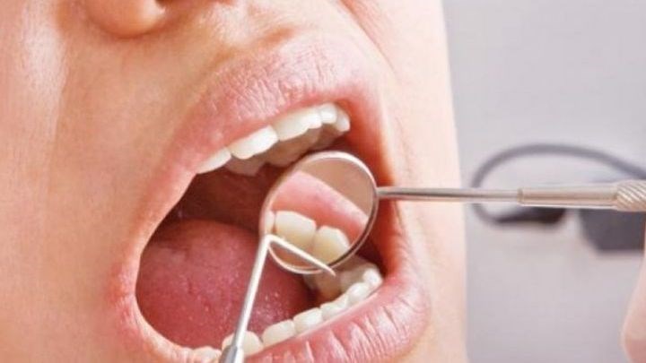 Λάρισα: Έκανε εξαγωγή δοντιού, γύρισε σπίτι της και κατέρρευσε