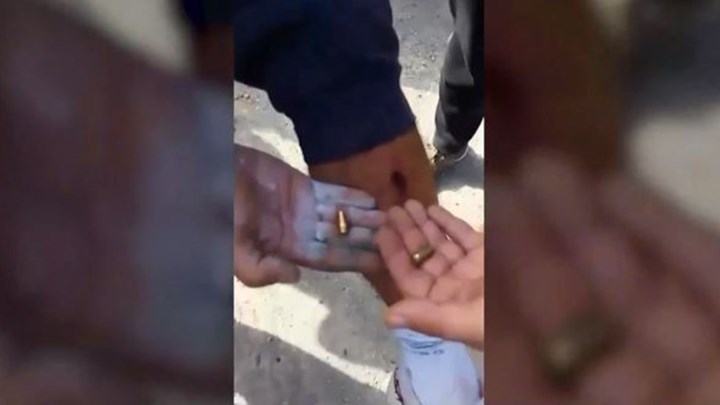 Λέσβος: Σοβαρά επεισόδια, τραυματισμοί και καταγγελίες για πυροβολισμούς από αστυνομικούς – ΒΙΝΤΕΟ