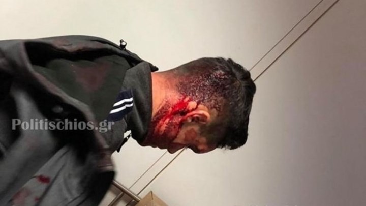 Μεταναστευτικό: Καταγγελίες για επίθεση των ΜΑΤ σε κατοίκους στη Χίο – ΦΩΤΟ – BINTEO