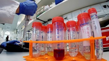 Κορονοϊός – ΗΠΑ: Θα σταλούν σε εργαστήρια έως τη Δευτέρα 2,1 εκατομμύρια τεστ