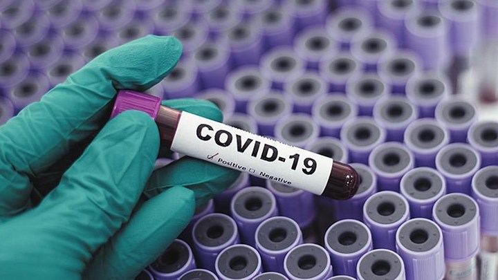 Κορονοϊός: Οδηγός επιβίωσης για τον ιό – Ο Πρύτανης του ΕΚΠΑ απαντά σε 12 κρίσιμα ερωτήματα