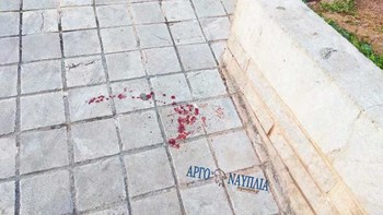 Ναύπλιο: Πήγε να του κόψει το κεφάλι με αλυσοπρίονο