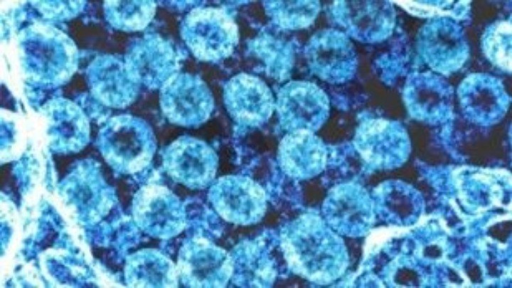 Κορονοϊός: Πρώτος θάνατος στην Πορτογαλία