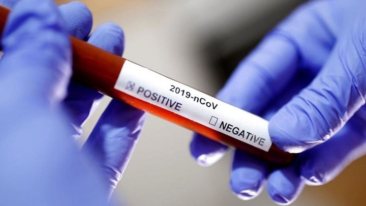 Κορονοϊός: Υπάρχει μεγαλύτερος κίνδυνος ανάλογα με την ομάδα αίματος; – Τι έδειξε νέα μελέτη