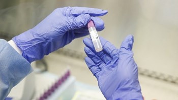 Κορονοϊός – Ρωσία: Ξεκίνησαν δοκιμές εμβολίου σε ζώα
