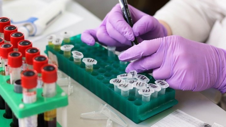 Κορονοϊός: Νέα έρευνα αποκαλύπτει πώς ο ιός μολύνει τον οργανισμό