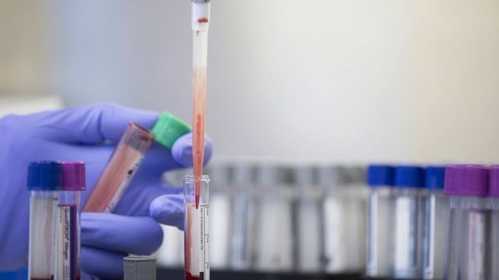 Κορονοϊός: Ενθαρρυντική η πιλοτική θεραπεία με πλάσμα αίματος ασθενών που ανάρρωσαν