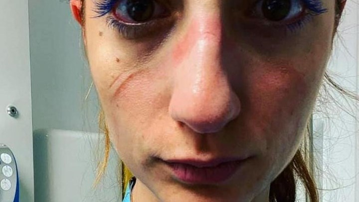 Συγκλονιστική μαρτυρία Ελληνίδας αναισθησιολόγου σε νοσοκομείο της Οξφόρδης: “Αυτό είναι το πρόσωπό μου”