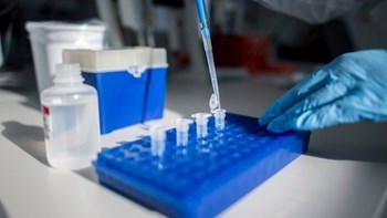 Κορονοϊός: Πρωτοποριακή έρευνα του ινστιτούτου Παστέρ και του Τσιόδρα για τις μεταλλάξεις του ιού