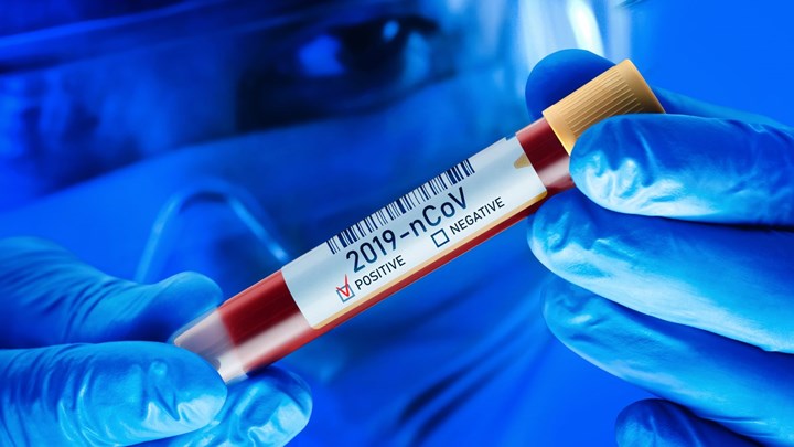 Κορονοϊός: Δοκιμές στη Βρετανία για το εάν η μετάγγιση με πλάσμα από επιζώντες του ιού βοηθά τους ασθενείς