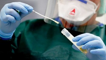 Κορονοϊός: Μύθοι και αλήθειες για την ανοσία στον ιό