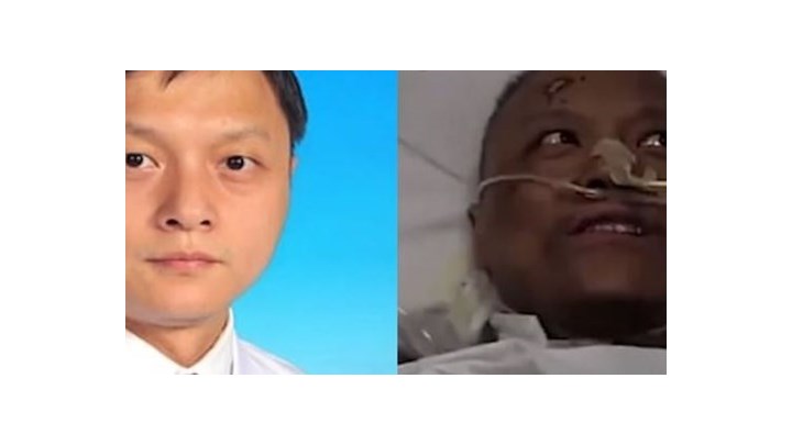 Κορονοϊός – Σπάνια επιπλοκή: Μαύρισε το δέρμα δύο ασθενών στην Κίνα – ΒΙΝΤΕΟ