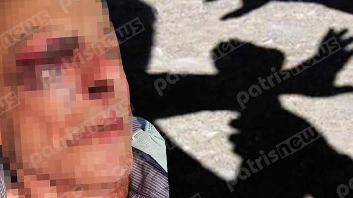 Ανδραβίδα: Άγριος ξυλοδαρμός συνταξιούχου από ληστές