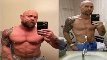 Σοκαριστική μεταμόρφωση ασθενούς με κορονοϊό: Το πριν και το μετά – ΦΩΤΟ