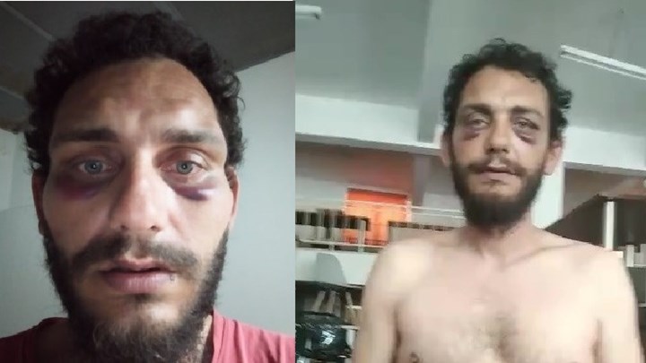 Ηράκλειο: Καταγγελία για αστυνομική βία – Με φώναζαν “Πακιστανό” και με έδειραν