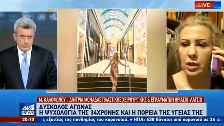Καλόφωνου: Θα μείνουν σημάδια στην 34χρονη από την επίθεση με βιτριόλι – ΒΙΝΤΕΟ