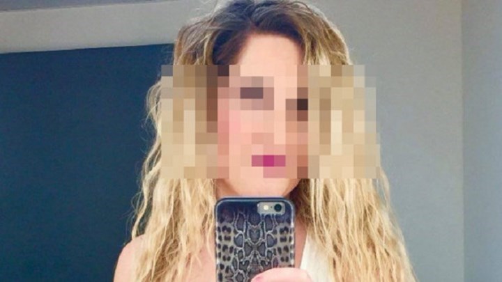 Επίθεση με βιτριόλι: Στο “μικροσκόπιο” των αστυνομικών συγκεκριμένα πρόσωπα από τον κύκλο της 34χρονης