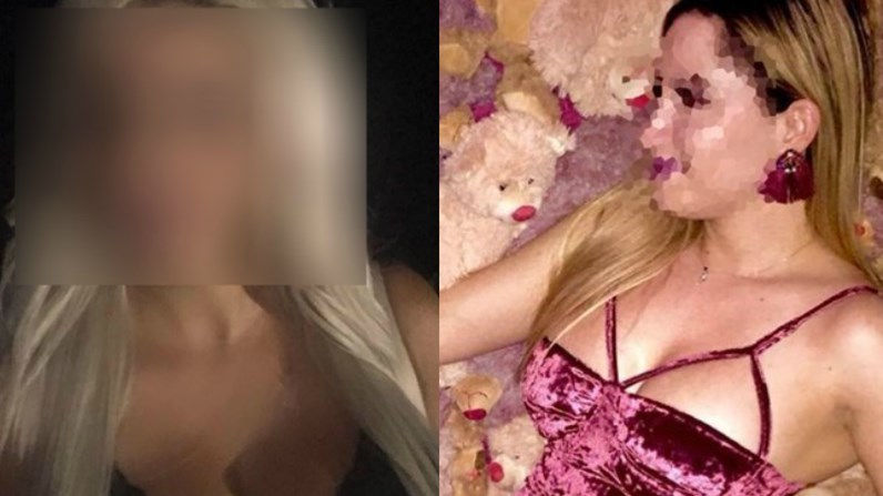 Επίθεση με βιτριόλι: Διασκέδαζε στο χωριό της το τριήμερο του Αγίου Πνεύματος η 35χρονη