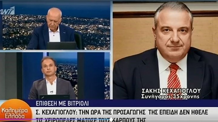 Επίθεση με βιτριόλι- Κεχαγιόγλου: Δεν τρώει και δεν κοιμάται η 35χρονη – Πώς μάτωσε τους καρπούς της