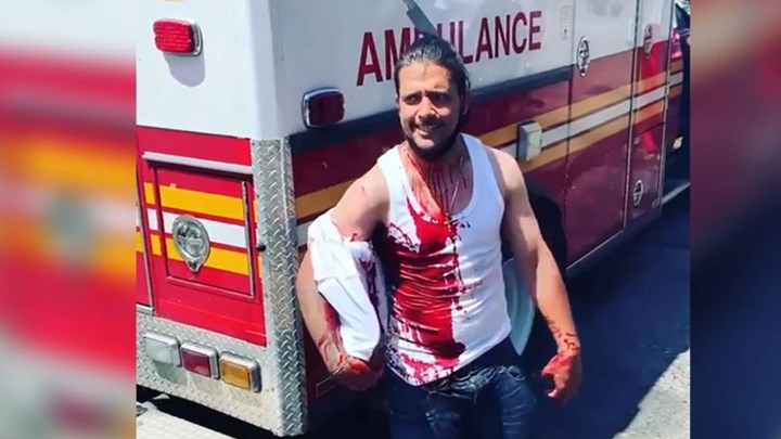 ΗΠΑ: Κατέληξε με ένα μαχαίρι καρφωμένο στο κεφάλι του έπειτα από καβγά – ΒΙΝΤΕΟ