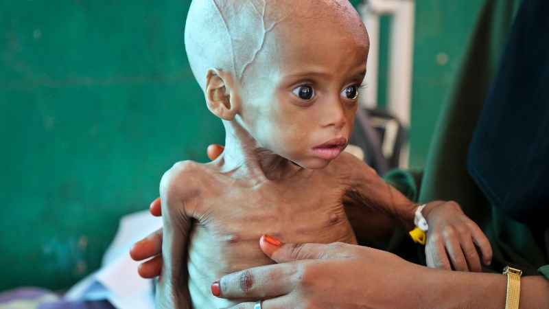 Ανθρωπιστική κρίση: Τα παιδιά πληρώνουν το βαρύ τίμημα του πολέμου στην Υεμένη – BINTEO