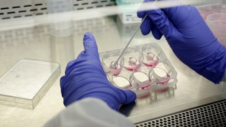 Κορονοϊός: Πιο μολυσματική η νέα μετάλλαξη του ιού – Τι έδειξε νέα μελέτη