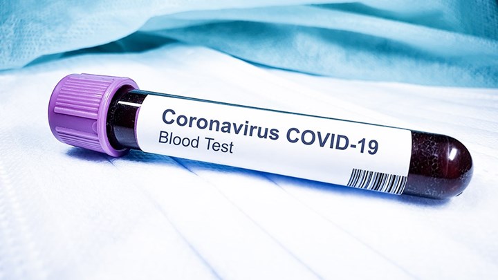 ΕΚΠΑ: Οι θάνατοι από κορονοϊό είναι περισσότεροι  – Οι περιπτώσεις που δεν καταμετρήθηκαν