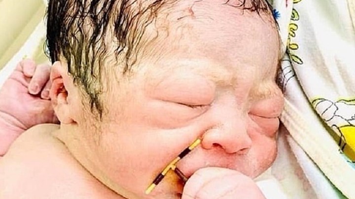 Βιετνάμ: Βρέφος γεννήθηκε με τον αντισυλληπτικό μηχανισμό στο χέρι – ΦΩΤΟ