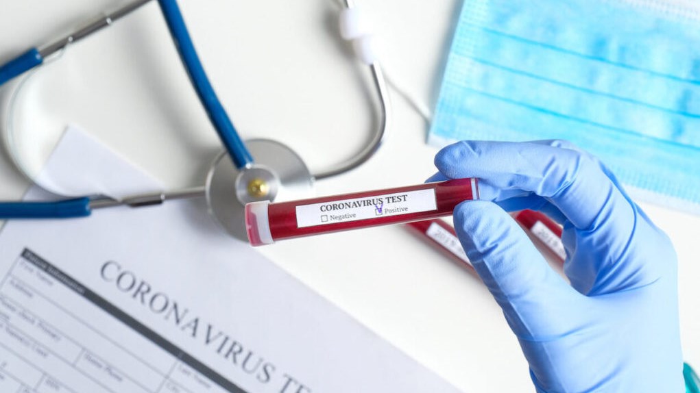 Κορονοϊός: Πού εντοπίστηκαν τα 26 νέα κρούσματα – Πόσα καταγράφηκαν σε Αττική και Θεσσαλονίκη