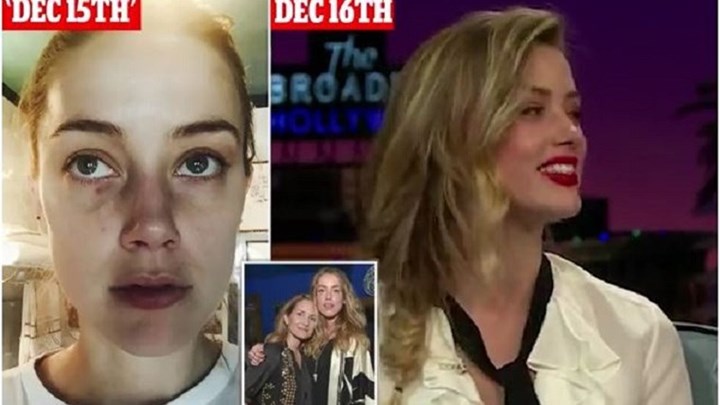 Άμπερ Χερντ: Ο Τζόνι Ντεπ μου μαύρισε και τα δύο μάτια- Σοκάρει η ΦΩΤΟ με τις ακαθαρσίες στο κρεβάτι